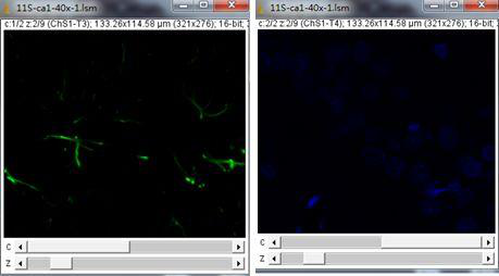 打开两通道层扫共聚焦荧光图片