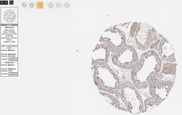 Testis查看组织免疫组化图
