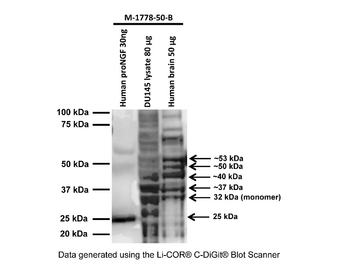 人DU145前列腺癌细胞裂解液和正常人脑中proNGF表达的Western blot分析