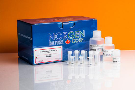 粪便RNA提取试剂盒特点和优势