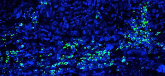 荧光标记的神经干细胞