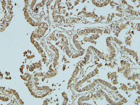 人输卵管，使用Abbkine Bcl-2单克隆抗体（ABM0010）， IHC-P 1:100稀释
