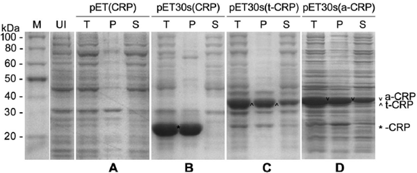 SDS-PAGE分析不同CRP重组载体