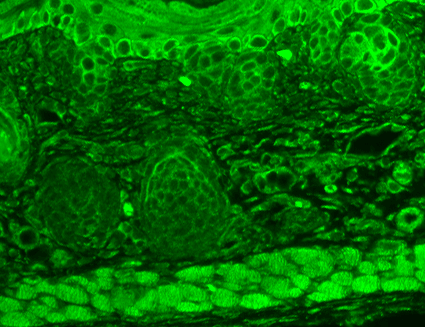 使用小鼠抗TrpC7单克隆抗体 (SMC-343) 对小鼠背部皮肤的免疫组化分析