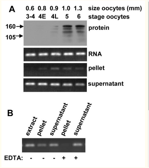 cyclin B1 mRNA在早期卵母细胞中被翻译抑制