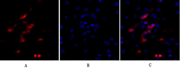 Abbkine p53