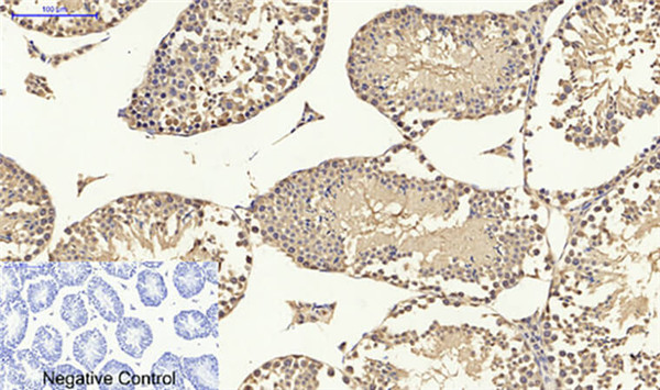 Abbkine p53