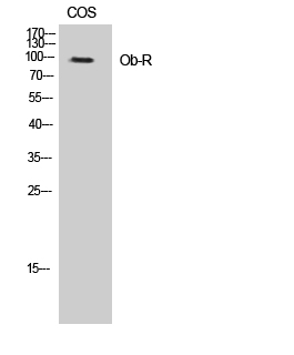 Ob-R Polyclonal Antibody WB 结果