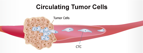 循环肿瘤细胞
