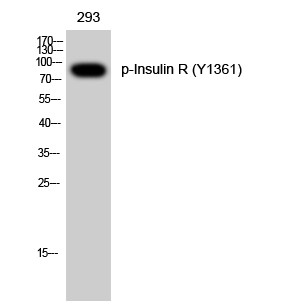293细胞，Phospho-Insulin R (Y1361) Polyclonal Antibody WB