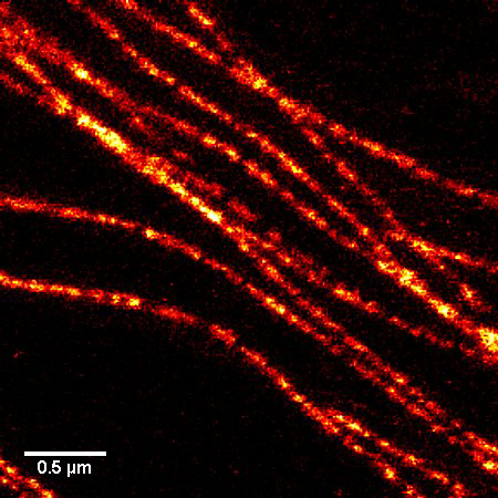 用SiR-微管蛋白标记的微管的STED显微图像
