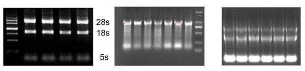 5s rRNA 的亮度