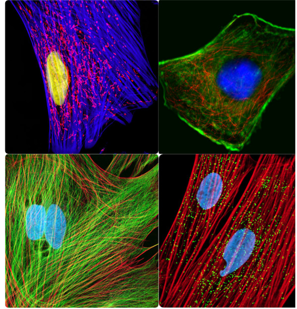 细胞骨架染色