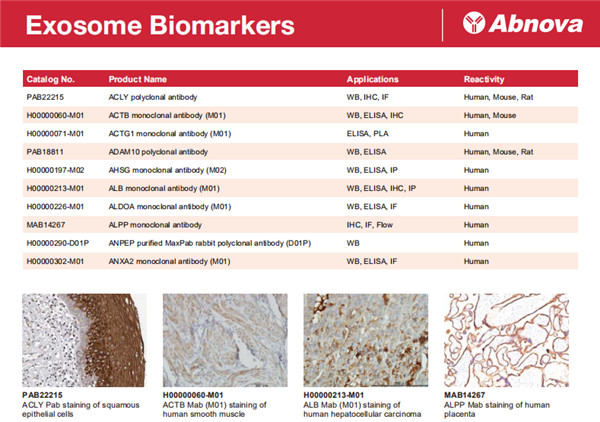 外泌体标志物研究抗体
