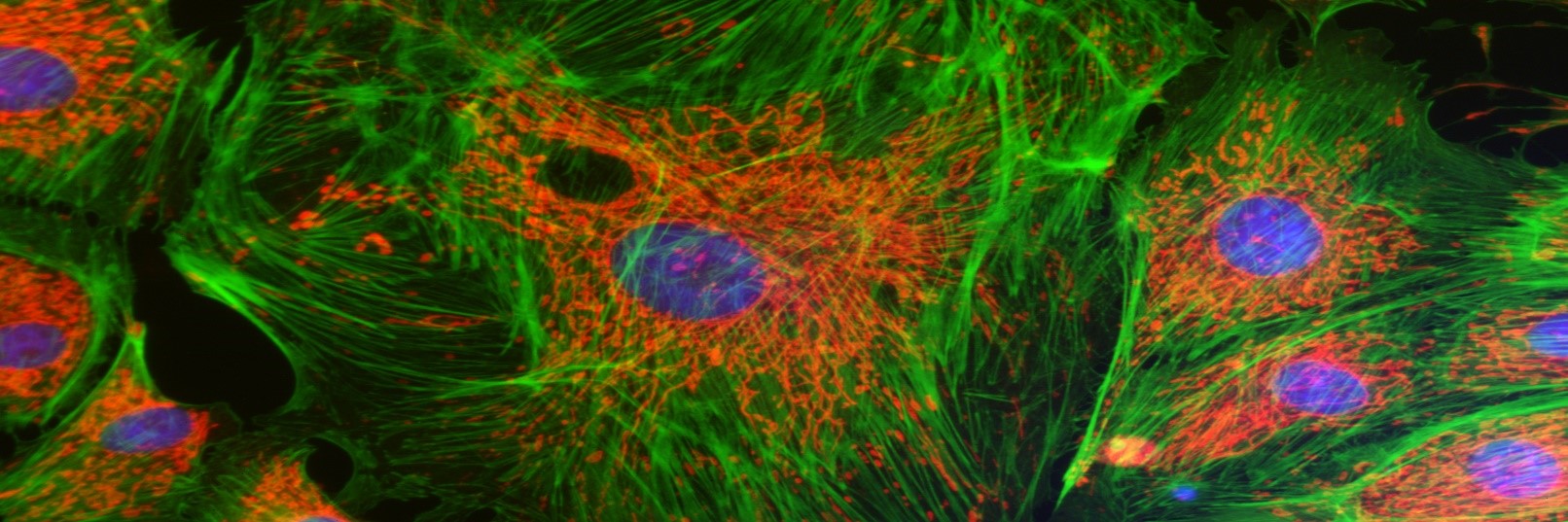 活細胞超分辨成像