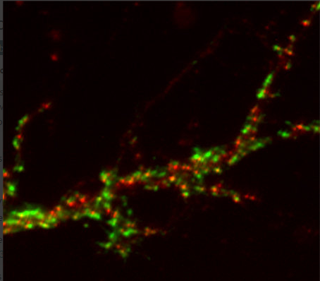 GABA-A receptor gamma2