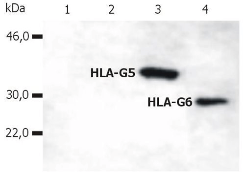  WB: HLA-G (5A6G7)