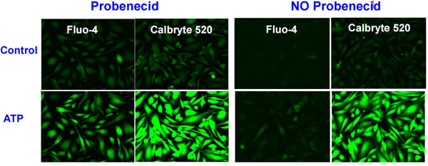 加或者不加丙磺舒（probenecid）对Fluo-4和Calbryte 520荧光标记结果的影响