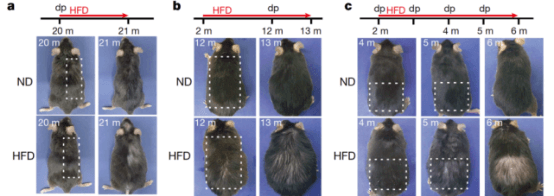 肥胖是如何通过损害毛囊干细胞导致脱发的