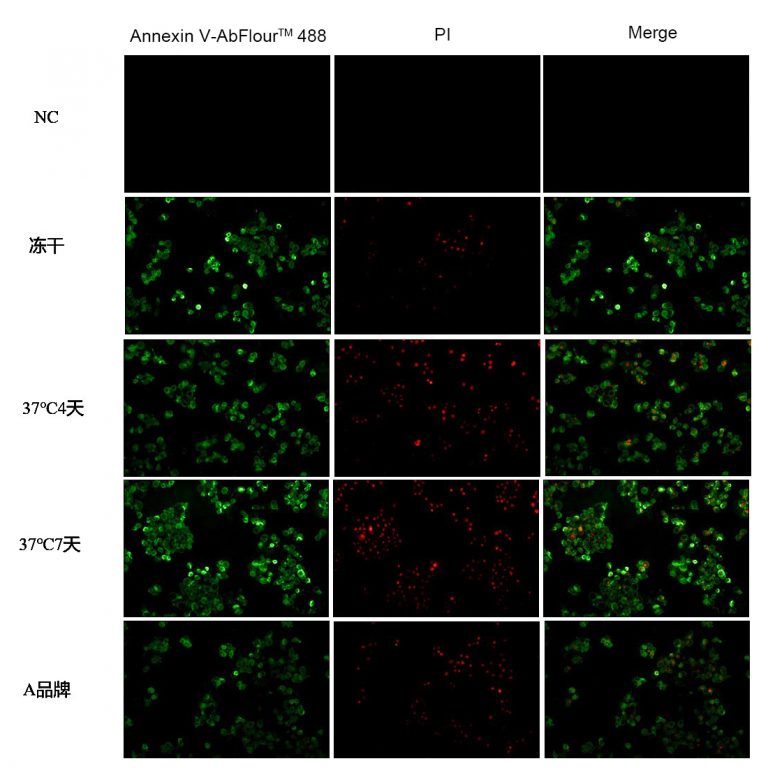 Annexin V/ANXA5