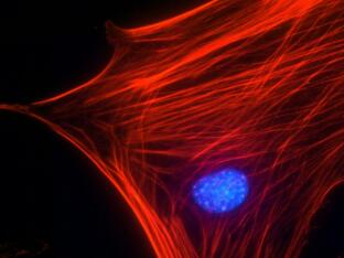Swiss 3T3 細胞肌動蛋白應激纖維染色