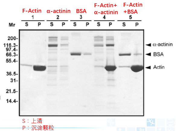 Actin结合蛋白分析试剂盒