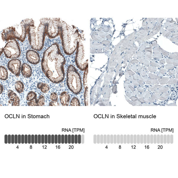 Occludin / OCLN