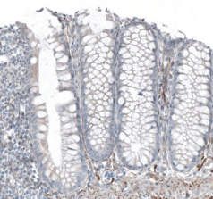 SALL4 / spalt-like transcription factor 4