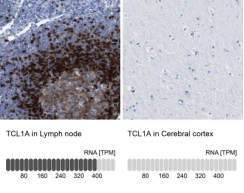 TCL1 / T-cell leukemia/lymphoma 1A