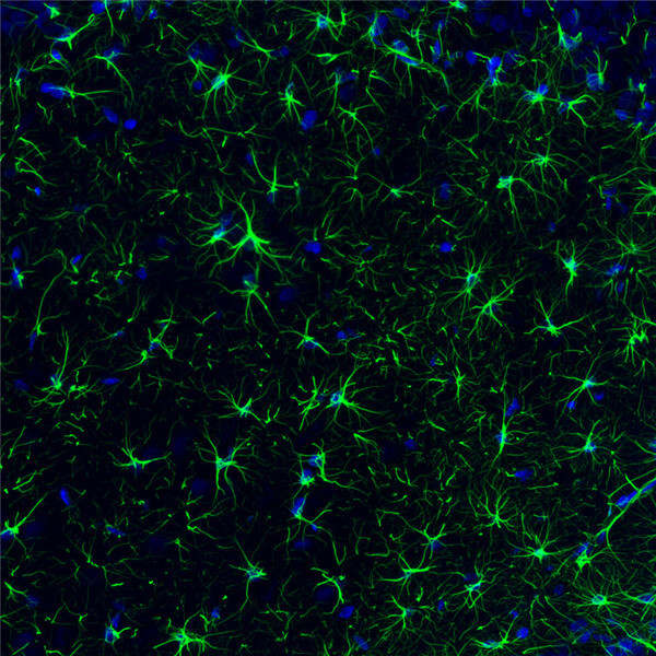 GFAP / glial fibrillary acidic protein