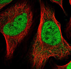 NACC1 / nucleus accumbens associated 1