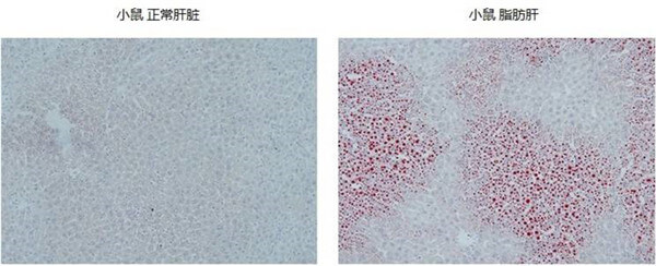 油红O染色小鼠肝脏结果