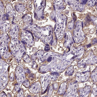 使用CD105抗体（HPA011862）人胎盘，IHC显示滋养层细胞中度膜阳性