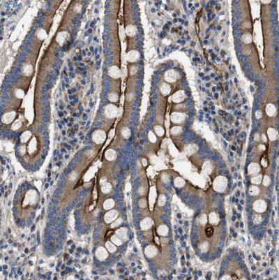 使用CD73抗体 （HPA017357）检测人十二指肠，IHC显示腺细胞顶端膜呈强阳性