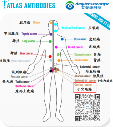 宫颈癌标志物