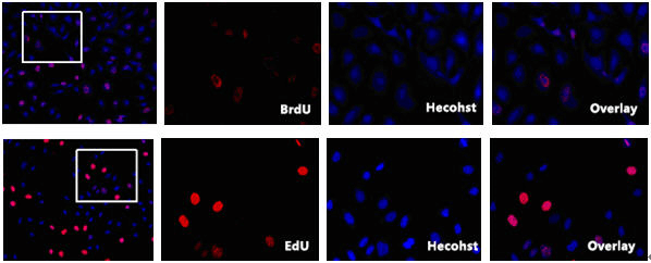 BrdU检测于EdU检测结果对比