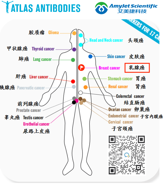 乳腺癌