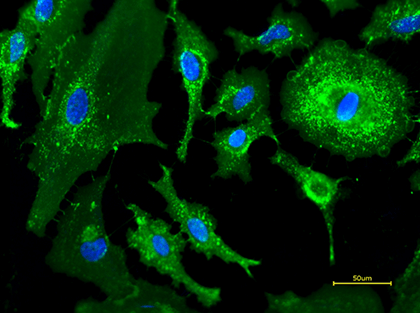 活的HeLa细胞用iFluor™ 488 WGA偶联物（绿色）和Hoechst 33342（蓝色）染色。
