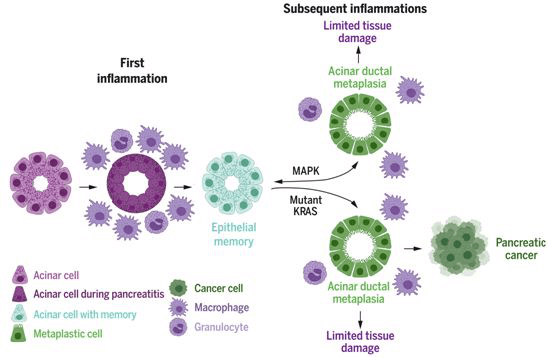 炎症的上皮细胞记忆限制组织损伤并促进胰腺肿瘤的形成