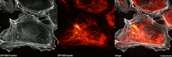 SPY650 FastAct(CY-SC505)和SPY555 tubulin(CY-SC203)共同染色HUVEC RCM2细胞