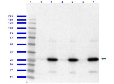 RFP/DsRed/tdTomato