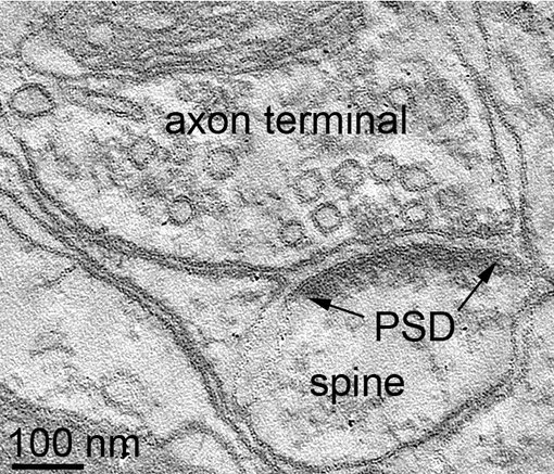 图3：大鼠海马结构突触的电子显微断层扫描图片