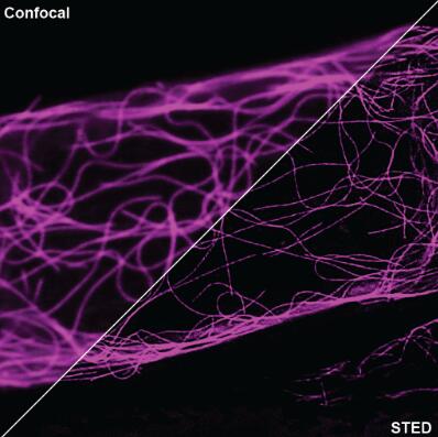 用共聚焦与STED显微镜成像的SPY标记的HeLa细胞的比较