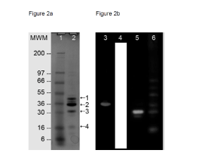 托莫肌苷/肌钙蛋白TCI复合物蛋白质纯度测定
