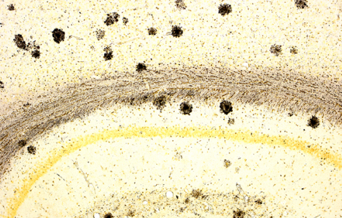 阿尔茨海默病模型小鼠大脑中神经退行性变和淀粉样斑块的检测