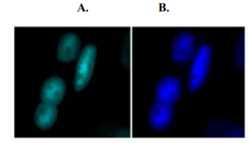 VU‐1免疫染色与PABPN1聚集物在人成肌细胞中共定位