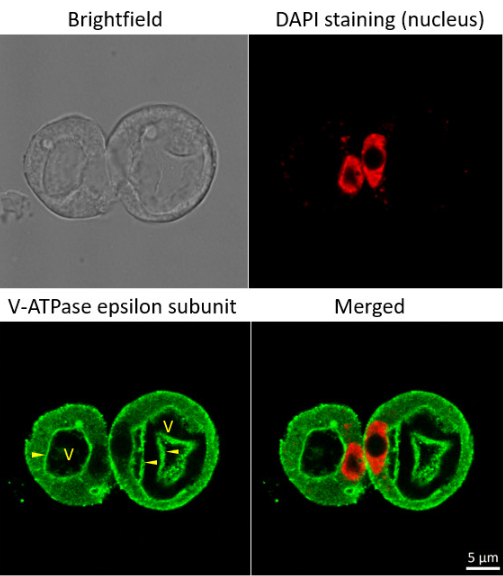 V-ATPase |液泡膜H + ATPase的Epsilon亚基