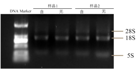 琼脂糖凝胶电泳分析