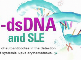 系统性红斑狼疮（SLE）血清学标志物(抗dsDNA抗体) 检测试剂盒