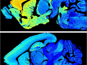 生物评论周报第122期：Science：绘制出小鼠全脑突触的终身变化图谱